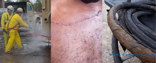 �߉���ϴ�C��ʹ���L(f��ng)�U